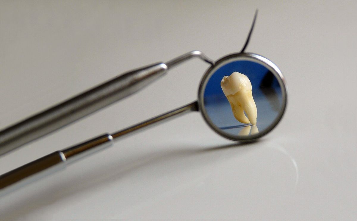 A dental mirror on a long handle reflecting a molar
